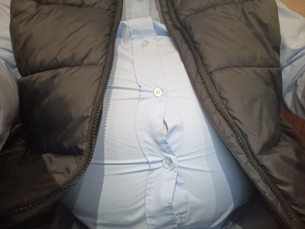 Previ&scaron;e Ugljenih hidrata